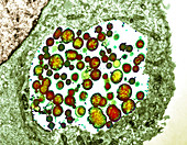 Chlamydia trachomatis bacteria,TEM