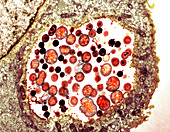 Chlamydia trachomatis bacteria,TEM