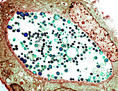 Chlamydia trachomatis bacteria,TEM