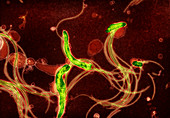 Spirochete bacteria,TEM