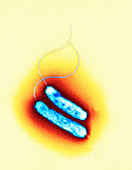 Campylobacter oral bacteria,TEM