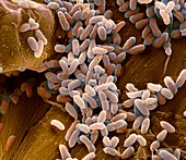 Pseudomonas aeruginosa bacteria,SEM