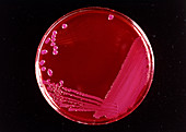 Petri dish culture of E. coli bacteria