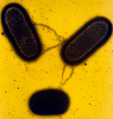 TEM of a male Escherichia coli bacterium