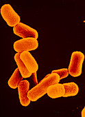 SEM of several Escherichia coli bacteria