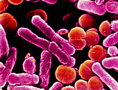 E. coli and Streptococcal bacteria