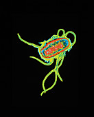 TEM of Escherichia coli bacteria