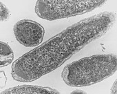 TEM of Escherichia coli 0157:H7 bacteria