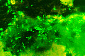E. coli bacteria,light micrograph