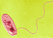 Legionella sp. bacterium,TEM
