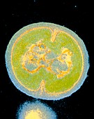 Staphylococcus epidermidis bacterium