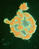 Bursting of Staphylo- coccus bacterium