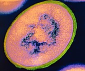 F/col TEM of Staphylococcus aureus