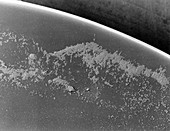 Staphylococcus bacteria on eye lens