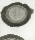 Drug resistant Staphylococcus bacteria