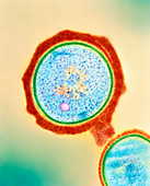 Drug resistant Staphylococcus bacteria