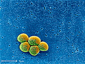 MRSA drug-resistant bacteria,SEM