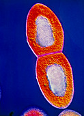 False-col TEM of Streptococcus sp