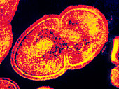 Coloured TEM of Enterococcus faecalis