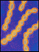 Chains of Streptococcus pyogenes bacteria