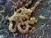 Streptococcus mutans bacteria,SEM