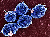 Streptococcus sp. bacteria,SEM