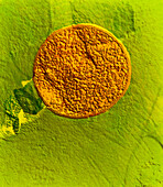 Extremophile bacteria Desulfurococcus