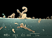 Nanobacteria