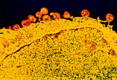 False-colour TEM of Mycoplasma sp