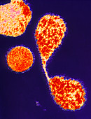 Coloured TEM of Mycoplasma pneumoniae