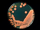 Petri dish culture of yeastlike organism