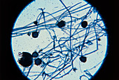 Hyphae and sporangia of bread mould