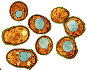 Yeast cells,TEM