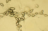 Phytophthora ramorum sporangia