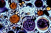 Algae grown for biofuel,light micrograph