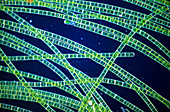 Green filamentous alga,Zygnema