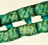 Spirogyra alga conjugating