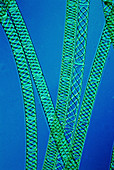 Filaments of Spirogyra algae