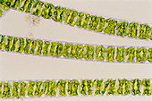 Filaments of Spirogyra alga