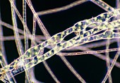 LM of conjugating filaments of Spirogyra