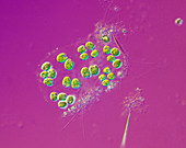 Algal colony,light micrograph