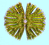 Desmid alga
