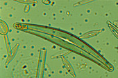 Diatom,Cymbella sp