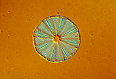 Marine diatom,Actinoptychus