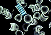 Diatom Campylodiscus Sp