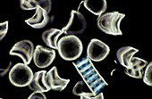 Diatom algae,Campylodiscus