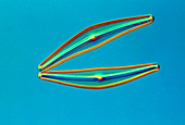 LM of the rod-shaped diatom,Cymbella sp
