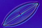 LM of a diatom,Navicula sp