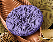 Diatoms,SEM