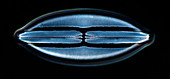 Diatom frustule,light micrograph